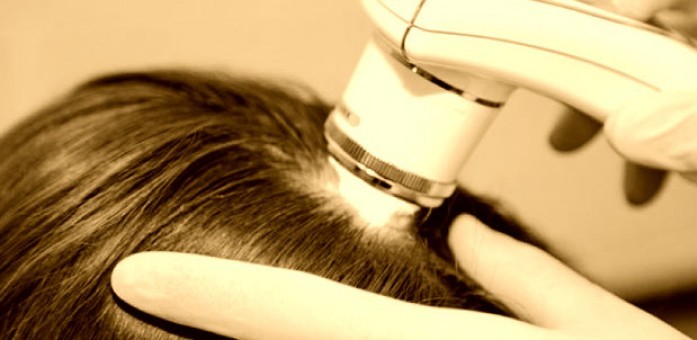Диагностика волос в Ольтераль Тольятти